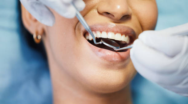 Trusted MO Emergency Dental Service Experts